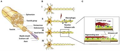 New techniques and methods for prevention and treatment of symptomatic traumatic neuroma: A systematic review